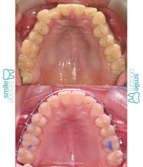 Smile Doctors Clinica Dental - Dra. Nathaly Mendoza