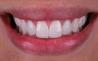 Clínica Odontológica Sorriso Mania Campinas | Dentista em Campinas