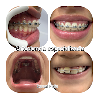 Dental Feliz