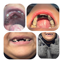 Dental Feliz