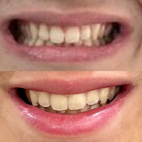 Qualis Clínica Odontológica