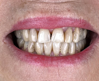 Qualis Clínica Odontológica