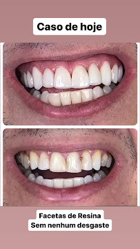 Qualis Clínica Odontológica