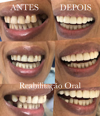 Qualis Clínica Odontológica