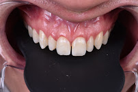 Black Dental