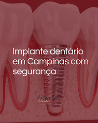 Mavsa Clínica Odontologica Especializada em Campinas