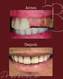 Rudini Odontologia | Implante Dentário | Dentista | Vila Nogueira | Campinas - SP