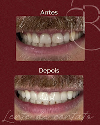 Rudini Odontologia | Implante Dentário | Dentista | Vila Nogueira | Campinas - SP