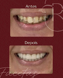 Rudini Odontologia | Implante Dentário | Dentista | Vila Nogueira | Campinas - SP