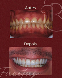Rudini Odontologia | Implante Dentário | Dentista | Vila Nogueira | Campinas - SP