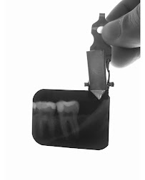Dr Marcelo Palma | Dentista em Campinas | Implante, facetas, canal, clareamento, restauração, extração de siso.