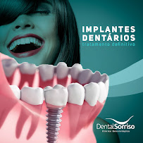 Dental Implantes Slz - Odontologia Especializada
