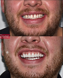 Denz Salud Dental