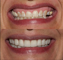 Denz Salud Dental