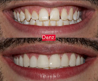 Denz Salud Dental Clinic in Guadalajara
