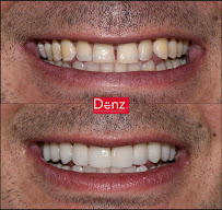 Denz Salud Dental