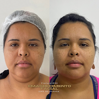 Dentes ONE