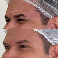 Dentes ONE
