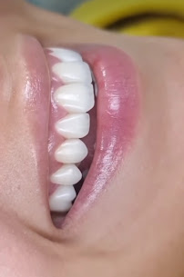Dentofes - Salud y Belleza Dental