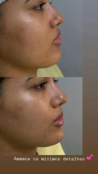 Clínica Peau Clin - Odontologia e Harmonização Orofacial