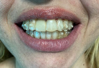 Clínica Teresa Longo - Ortodontia e Ortopedia Facial - Invisalign Doctor