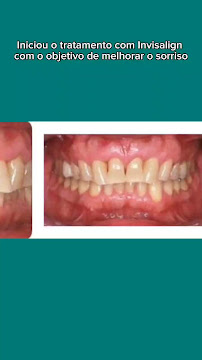 Clínica Teresa Longo - Ortodontia e Ortopedia Facial - Invisalign Doctor