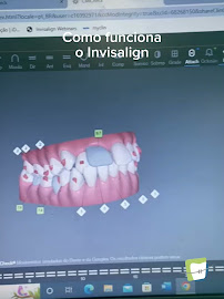 Clínica Teresa Longo - Ortodontia e Ortopedia Facial - Invisalign Doctor