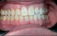 Clínica Teresa Longo - Ortodontia e Ortopedia Facial - Invisalign Doctor