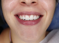 Clínica Teresa Longo - Ortodontia e Ortopedia Facial - Invisalign Doctor