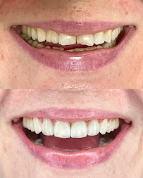 Clínica Teresa Longo - Ortodontia e Ortopedia Facial - Invisalign Doctor
