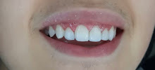Clínica Teresa Longo - Ortodontia e Ortopedia Facial - Invisalign Doctor