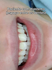 Clínica Teresa Longo - Ortodontia e Ortopedia Facial - Invisalign Doctor