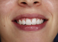 Clínica Teresa Longo - Ortodontia e Ortopedia Facial - Invisalign Doctor