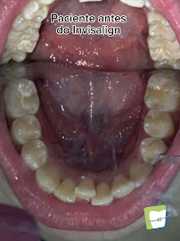 Clínica Teresa Longo - Ortodontia e Ortopedia Facial - Invisalign Doctor