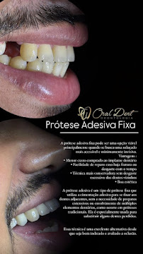 Oral Dent Maceió
