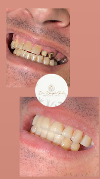 Dra. Rosangela Santos | Dentista em Maceió | Facetas em Resina em Maceió