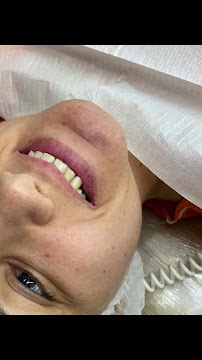 Dra. Rosangela Santos | Dentista em Maceió | Facetas em Resina em Maceió