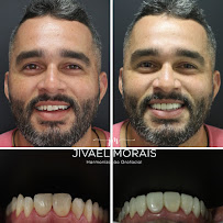 Instituto Jivael Morais - Dentista Maceió - Urgência 24h