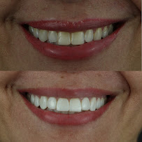 Instituto Jivael Morais - Dentista Maceió - Urgência 24h