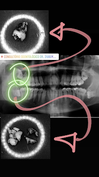 Instituto Jivael Morais - Dentista Maceió - Urgência 24h
