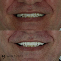 Instituto Jivael Morais - Dentista Maceió - Urgência 24h