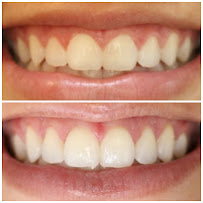 Instituto Jivael Morais - Dentista Maceió - Urgência 24h
