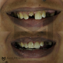 Instituto Jivael Morais - Dentista Maceió - Urgência 24h