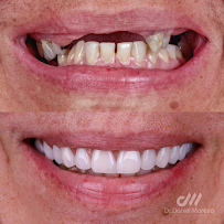 Dr. Daniel Moreira - Dentista Maceió 24h
