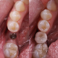 Dr. Daniel Moreira - Dentista Maceió 24h