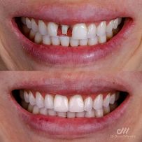 Dr. Daniel Moreira - Dentista Maceió 24h
