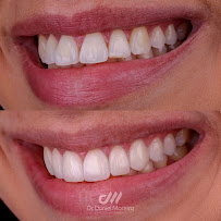 Dr. Daniel Moreira - Dentista Maceió 24h