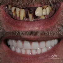 Dr. Daniel Moreira - Dentista Maceió 24h