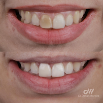 Dr. Daniel Moreira - Dentista Maceió 24h