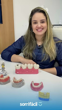Sorrifácil Maceió | Implantes, Prótese Protocolo, Reabilitação Oral e Lentes de Contato
